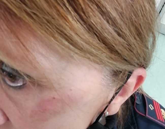 vercelli agente polizia ferita